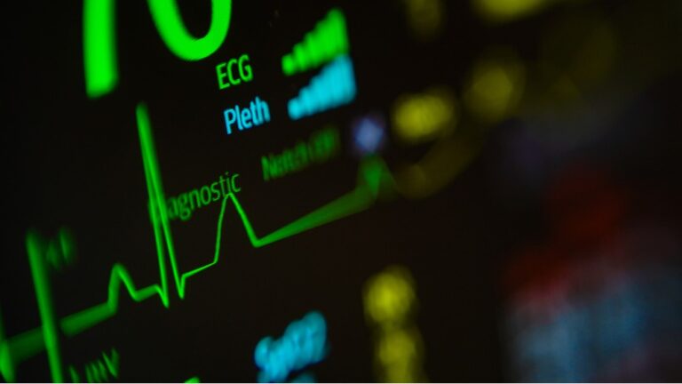 ECG