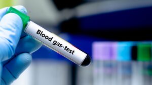 The Role of Blood Gas Testing and AARC’s New Resource for RTs