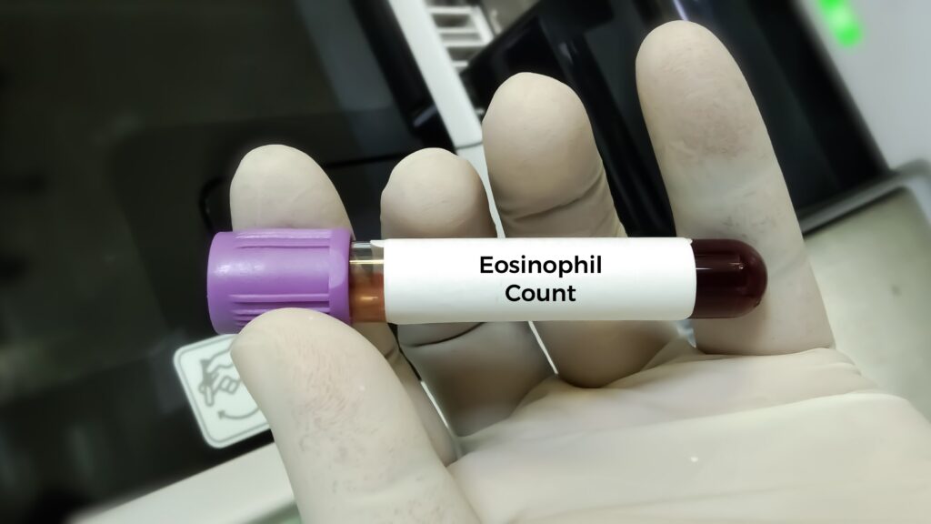 blood eosinphils