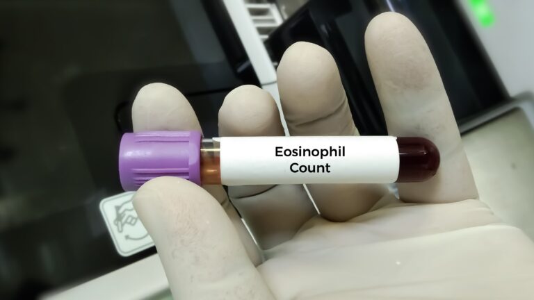 blood eosinphils